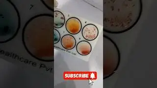 Thik is a blood group test ❤️|| koi bta sakta hai kon sa group h 😘😊