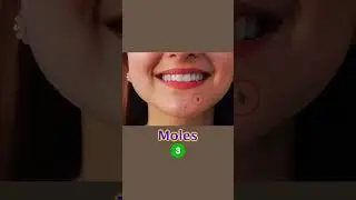 How to manage moles & open pore: Skin Care Tips | Dr. Sarin |