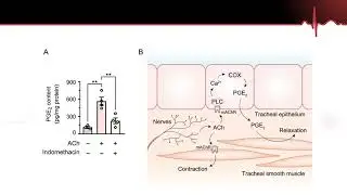 Chemical Messengers Part 2. How NSAIDs Work to Help Headaches. Agonist vs Antagonist.