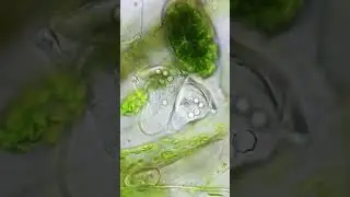 Microbes BATTLE for SURVIVAL under the Microscope #microscope #biology