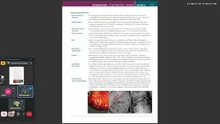 USMLE step 1 prep: lecture 6 (pathology of GI 3)
