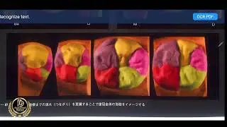 morphology  lower second molar part 14 _شرح الرحى الثانية السفلية
