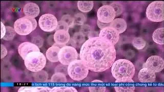 ThinPrep VTV1