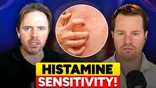 Why Healthy Foods Trigger You - The Histamine Problem