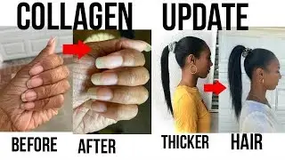COLLAGEN UPDATE FOR THICKER HAIR AND LONGER NAILS