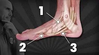 6 EJERCICIOS para fortalecer los PIES, evitar ca&iacute;das y prevenir lesiones