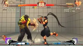 Ultra Street Fighter IV: sergito_DX /Ibuki/ vs wenawum /Dee Jay/