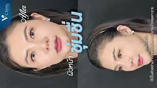 Hydrobooster หมอไหม