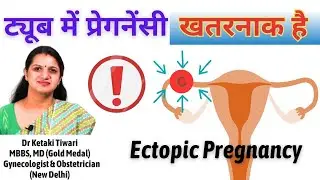 Ectopic Pregnancy | ट्यूब में प्रेग्नेंंसी । बच्चा गर्भाशय के बाहर विकसित होना । बेहद खतरनाक