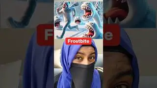 🥶Literal vs Reality English COMPOUND Words | frostbite #shorts #learnenglish