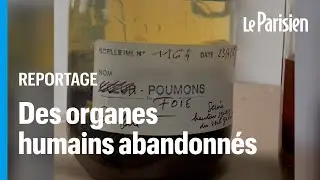 Un foetus et des organes humains retrouv&eacute;s dans le laboratoire d&eacute;saffect&eacute; d'un h&ocirc;pital