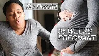 35 WEEK PREGNANCY UPDATE | STRUGGLING WITH SYMPHYSIS PUBIS DYSFUNCTION (SPD) | SO PAINFUL!