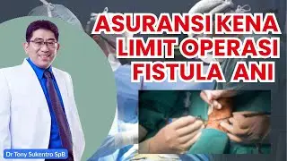 ASURANSI KENA LIMIT ! TENANG OPERASI FISTULA ANI BISA LANCAR DENGAN INI... #fistulaani #viral #wasir