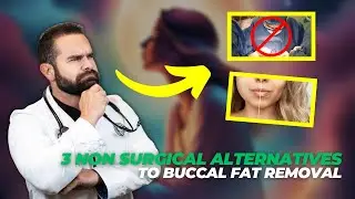 3 Non-Surgical Alternatives To Buccal Fat Removal