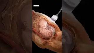 Amniocentesis Explained in 60 Seconds | Prenatal Test for Genetic Disorders