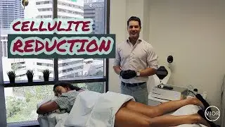 Reduce Cellulite With These Two Treatments