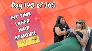 Day 190 of 365: FIRST TIME LASER HAIR REMOVAL - PCOS CARE