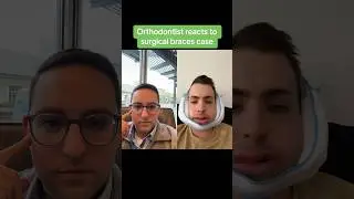 This is what REALLY happens after double jaw surgery. 🤕🦷⏱️ #braces #jawsurgery #teeth