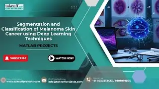Segmentation and Classification of Melanoma Skin Cancer using Deep Learning Techniques
