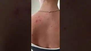 PanOxyl Acne Banishing Body Spray Post-workout Routine
