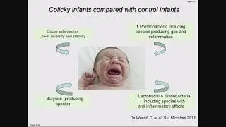 01 Functional Abdominal pain Disorders in Infants and Children By Dr Nikhil Thapar