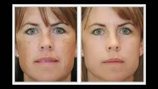 Featuring on Dr Cathy Davies's show, OUTPATIENTS, creating results, deeper than skin deep.