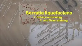 Serratia liquefaciens Colony morphology and Gram staining
