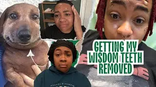 getting my wisdom teeth removed | PAINFUL!!