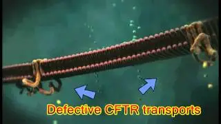 Defective CFTR  animation