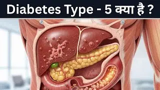 What Is Type 5 Diabetes? All You Need to Know