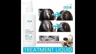 Top 3 Hair Care Products in India That Actually Work