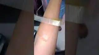 normal Honey wax hand hair remove 🔥🔥#shortvideo #trending #viralvideo #viralshort #shorts