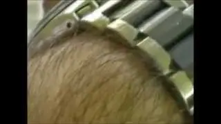 hairy arms