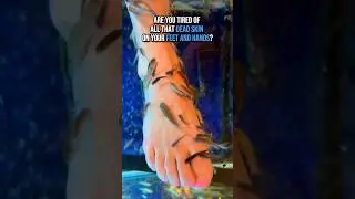 Say goodbye to pesky dead skin and hello to silky-smooth feet and hands at Fish Kiss Spa in Provo!🐠