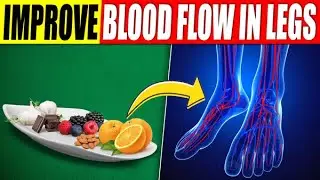 13 Amazing Foods to Improve Your Blood Circulation in Legs
