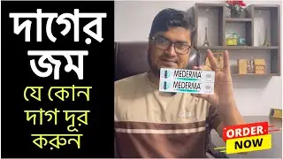 Mederma Scar Removal Gel | সার্জারির দাগ দ্রুতগতিতে দূর করে যে ক্রিম | Advanced Mederma Plush