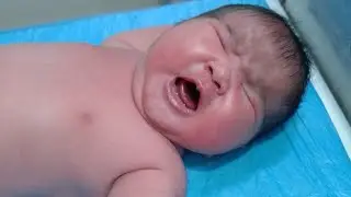 Overweight Newborn Baby 5.5kg | IDM Baby RBS & Feeding Care in NICU 💕