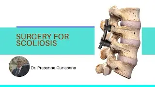 Surgery for Scoliosis