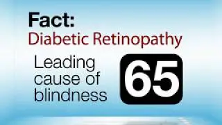 diabetes and the eyes