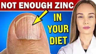 13 signs of zinc deficiency you should NOT ignore (AND WHAT TO DO)