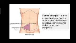 Acute Appendicitis #Surgery #medical #education #yt #viralvideo #notes