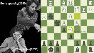 Amazing chess match ♟️👸⏩ on Day 20 #chess #chessmatch #chessgames 