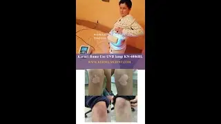 Light therapy for #vitiligotreatment #psoriasistreatment with Kernel UVB Phototherapy lamp KN-4006BL