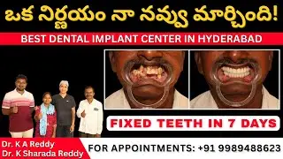 Advanced Zygomatic & Full Mouth Implants Hyderabad, Fixed Teeth in 7 Days, ఇమీడియట్ ఇంప్లాంట్స్