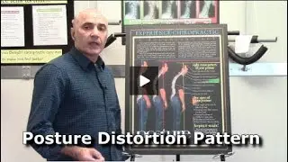 Postural Distortion Can Increase Stumbles And Falls | Burlington Ontario