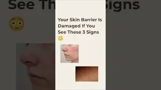 These 3 signs mean your skin barrier needs help 😳Go gentle -glow stronger ✨#skinpositivity#greatskin