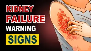Are You Ignoring the Silent Symptoms of Kidney Disease?