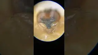 Yellow sac spider under a microscope. #Shorts