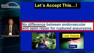 The Debate Is Over: EVAR Is The Best Treatment For RAAA Patients  -  Martin Malina, MD, PhD