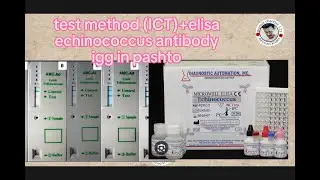 echinococcus antibody igg test /hydatid worm/echinococcosis disease /tape worm granulsus in pashto